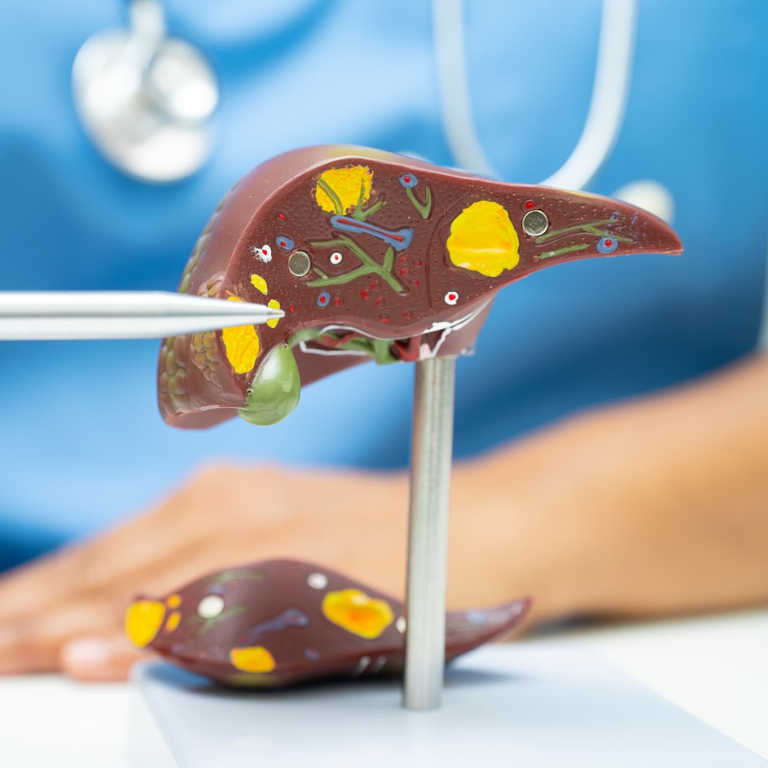 Medical illustration of CAR-T cell therapy process